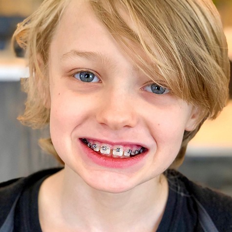 Portrait of preteen boy with braces