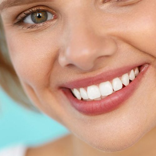 Close-up of woman’s smile with perfect teeth