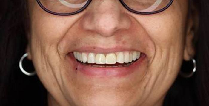 Portrait of patient with beautiful smile