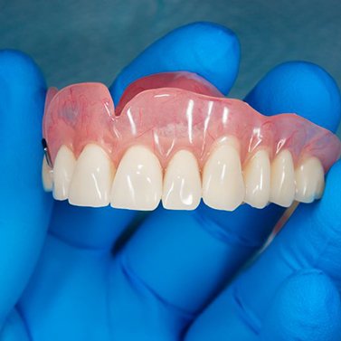 Gloved hand holding full upper denture