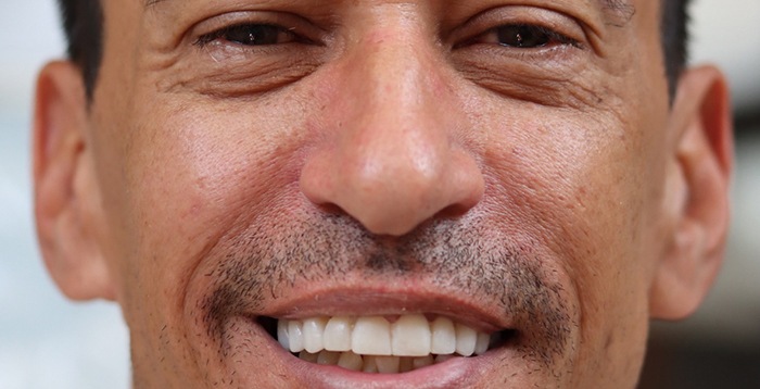 Smiling man with nice teeth after treatment at Landmark Dental Studio