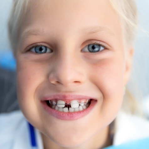 child smiling with gap in teeth