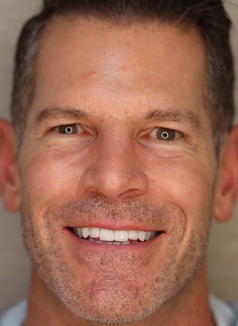Portrait of Landmark Dental Studio patient after smile makeover