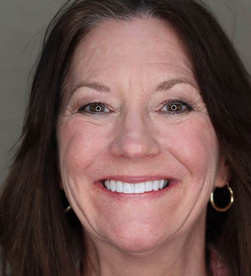 Smiling middle-aged woman with perfect teeth after smile makeover at Landmark Dental Studio