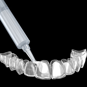 Digital image of take-home teeth whitening supplies
