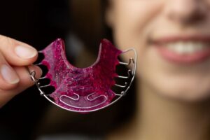 Young woman holding an orthodontic retainer 